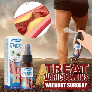 Spray - Anti Varices